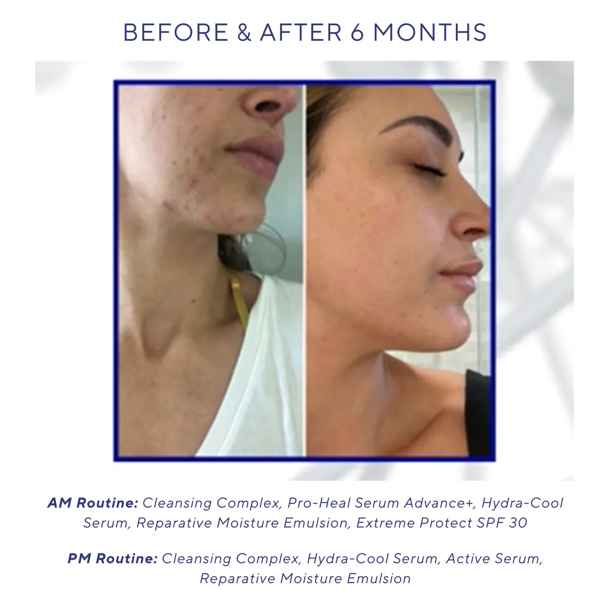 Before and after comparison of a woman's face with text about a skincare routine.