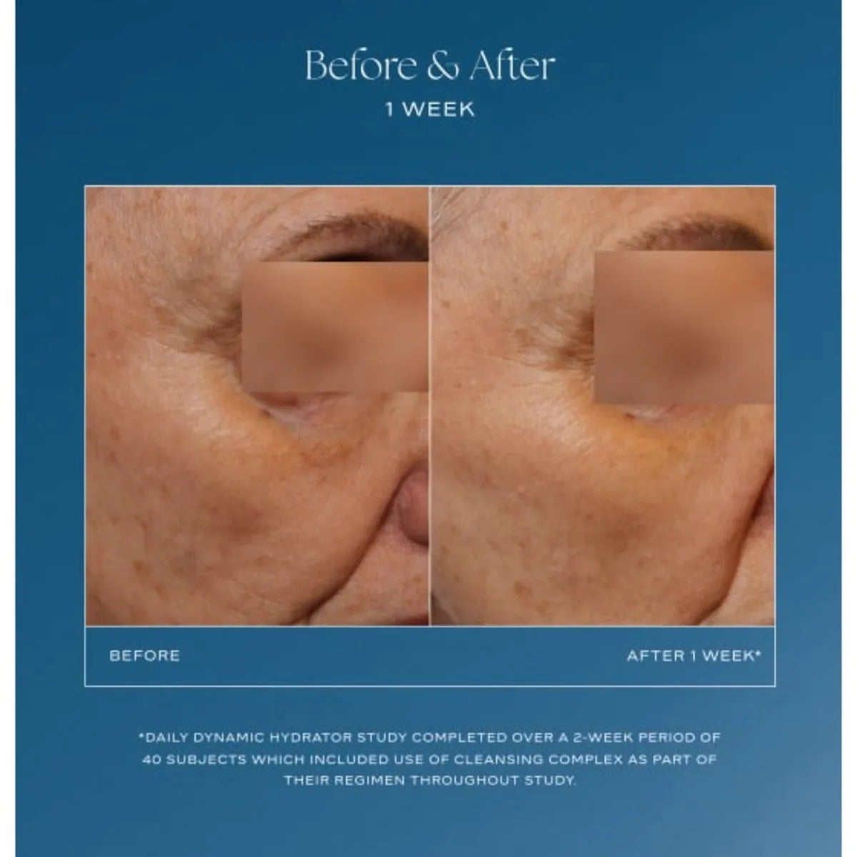 Before and after skin comparison on a blue background with text about a daily dynamic hydrator study.