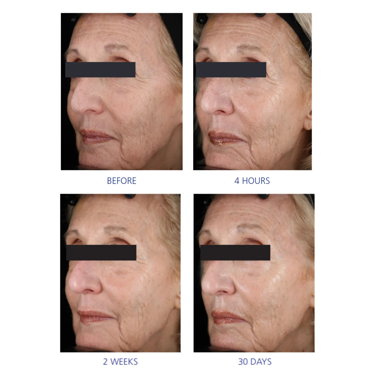 Before and after photos of woman
